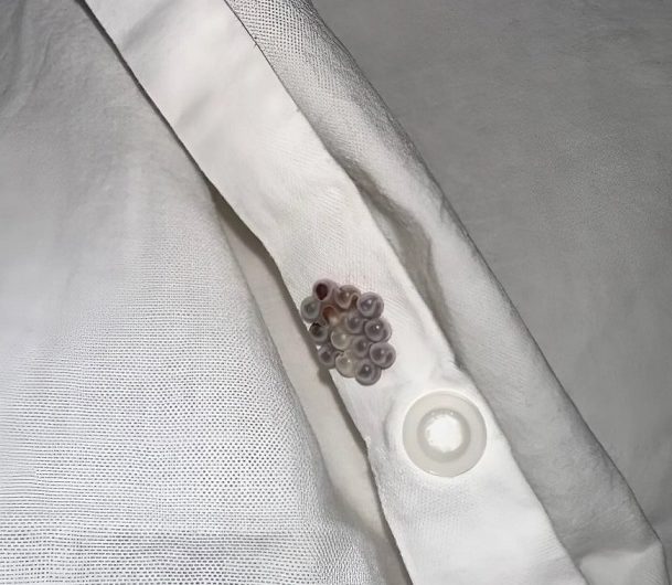 Diese kleinen Kugeln lagen plötzlich in meinem Bett – und ich hatte keine Ahnung, was es war…