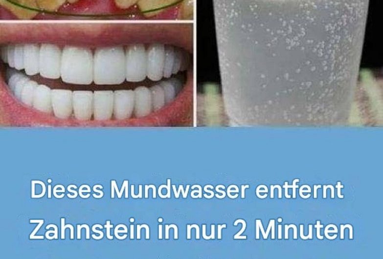 So werden Ihre Zähne wirklich weiß – mein ausführlicher Erfahrungsbericht mit 15 alltagstauglichen Strategien