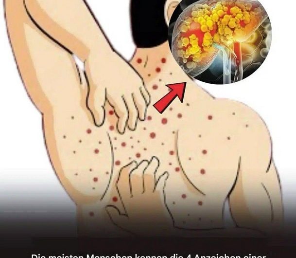 Diese still wachsende Gefahr bedroht Ihre Leber – und Sie merken es nicht mal