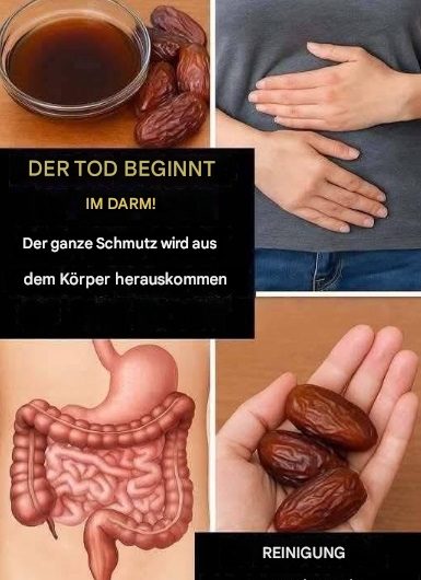 Reinige deinen Darm – und du veränderst dein Leben“: Wie Datteln den Körper entgiften und den Darm sanft heilen können