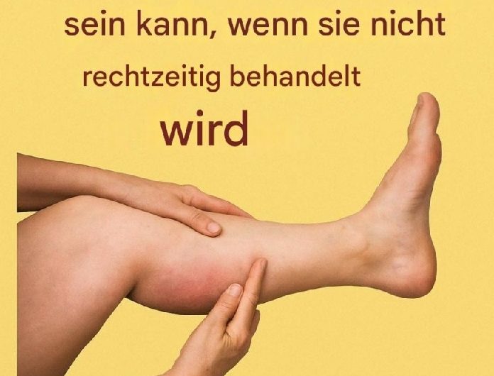 Die 6 besten Infusionen für gesunde Arterien