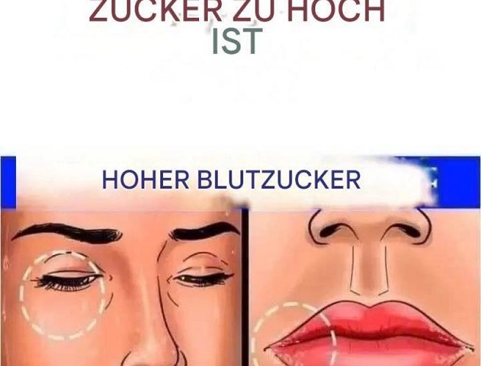 Wenn Der Zuckerhaushalt Aus Dem Gleichgewicht Gerät – Gedanken Einer Hausfrau Aus Dem Alltag