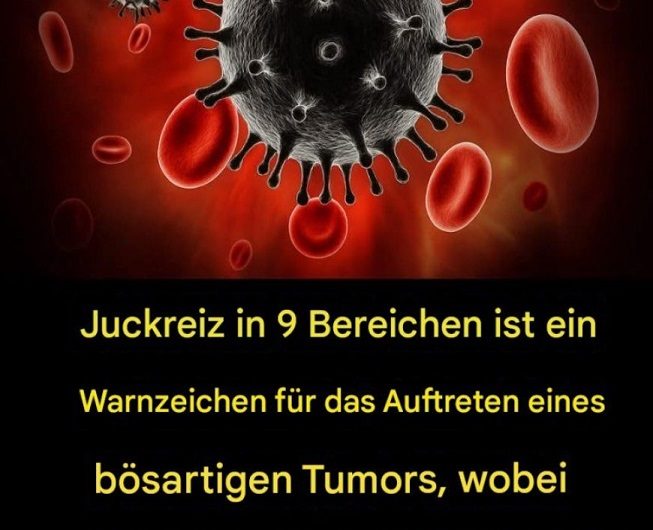 Wenn der Körper leise warnt: Warum Juckreiz manchmal mehr sein kann, als man denkt