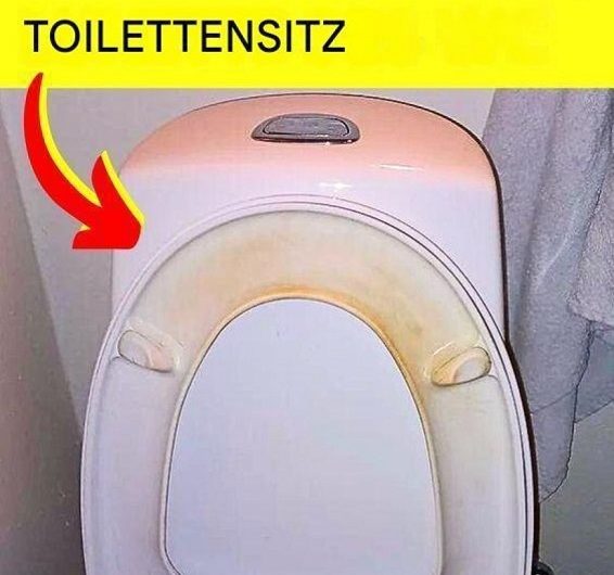 Der einfache Trick gegen gelbe Flecken auf dem WC-Sitz – mit Hausmitteln wird alles wieder strahlend sauber