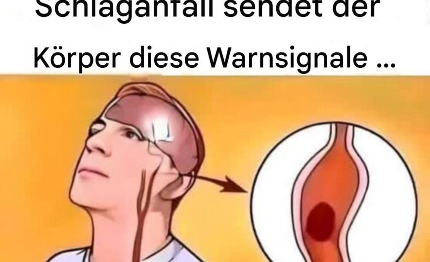 Schlaganfall erkennen: Die Warnzeichen, die man niemals ignorieren sollte