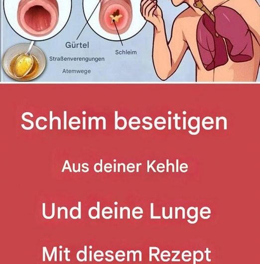 Honig und Zitrone gegen Husten? Was dieses einfache Hausmittel wirklich kann