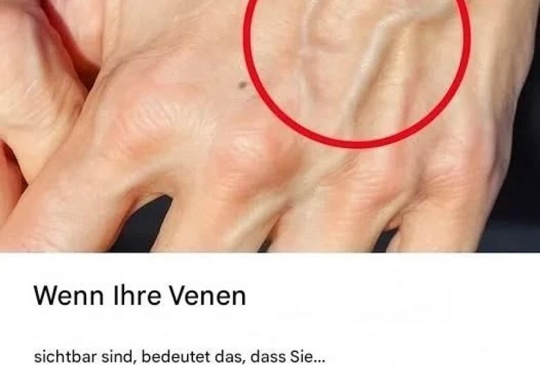 Wenn plötzlich die Venen sichtbar werden – Was Ihr Körper Ihnen damit sagen möchte