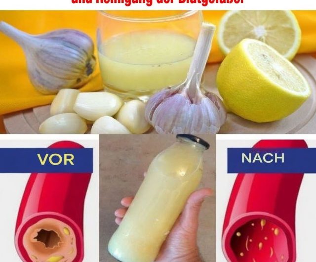 Meine Oma kannte dieses einfache Rezept schon: Zitronen-Knoblauch-Wasser aus nur 3 Zutaten! 🍋🧄